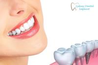 Sydney Dental Implant image 5